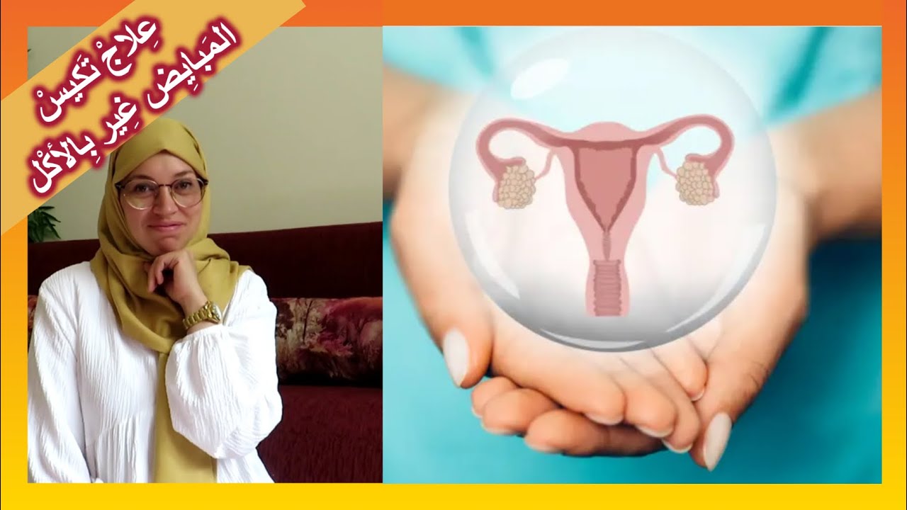 تكيُّس المَبايِض🤔أسْبابُه، أعْراضُه وعِلاجُه غِير بِالأكْل😉+عشْبة طبِيعِية مُعجِزة