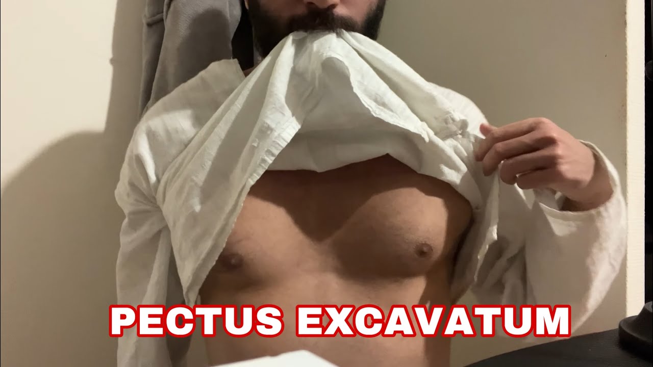 ASMR FRANÇAIS | MON PLUS GROS COMPLEXE… Pectus Excavatum | PARTIE 2