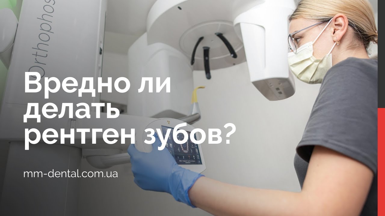 🇺🇦 Чем отличается рентген зуба от КТ и панорамного снимка