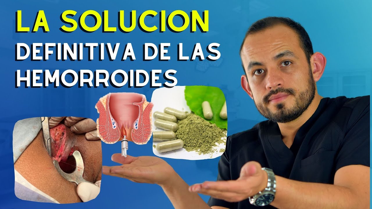 🟢 𝗠𝗘𝗝𝗢𝗥 𝗧𝗥𝗔𝗧𝗔𝗠𝗜𝗘𝗡𝗧𝗢 para las hemorroides ¿Cirugía, ligadura o medicamentos?