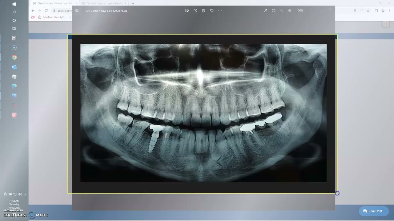 ClaimX & DXC Attachment Interface Training Video