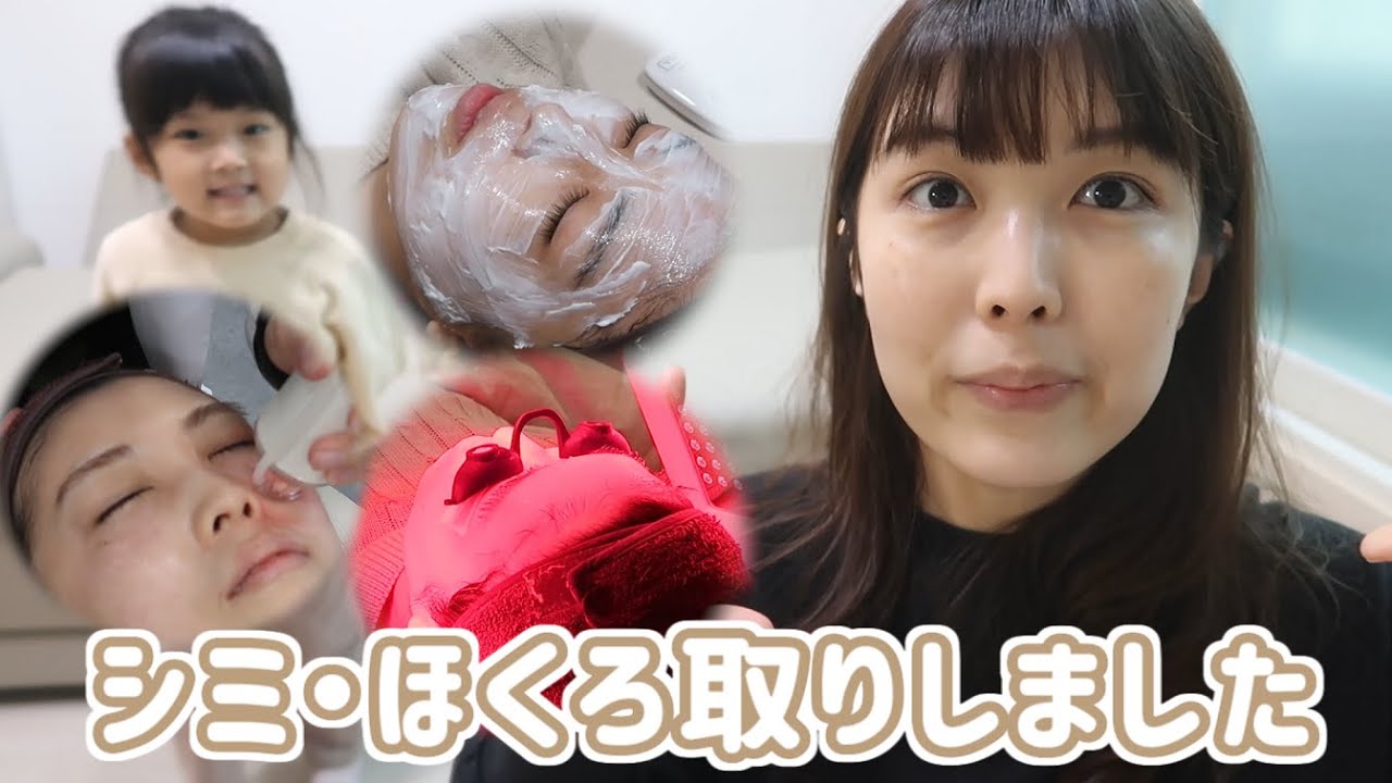 韓国の美容クリニックでシミ・ほくろ取りをしてきました！