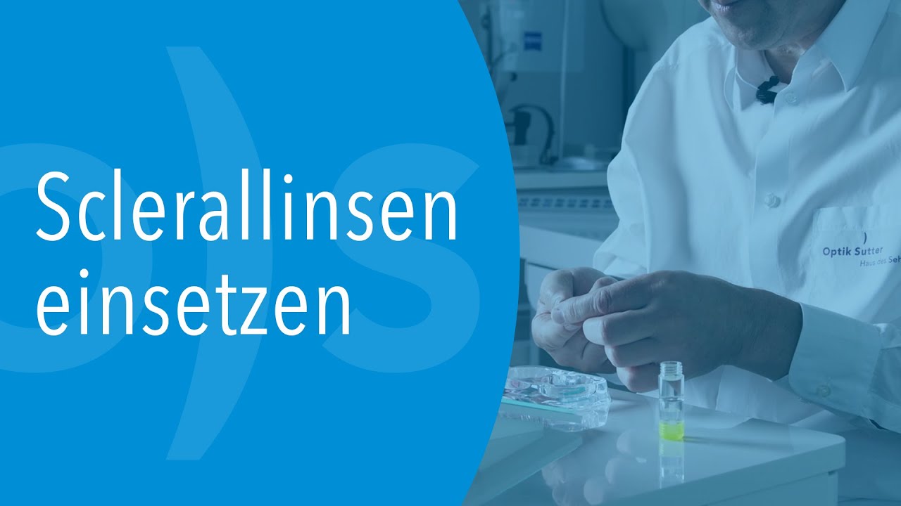 Optik ) Sutter -  Sclerallinsen einsetzen