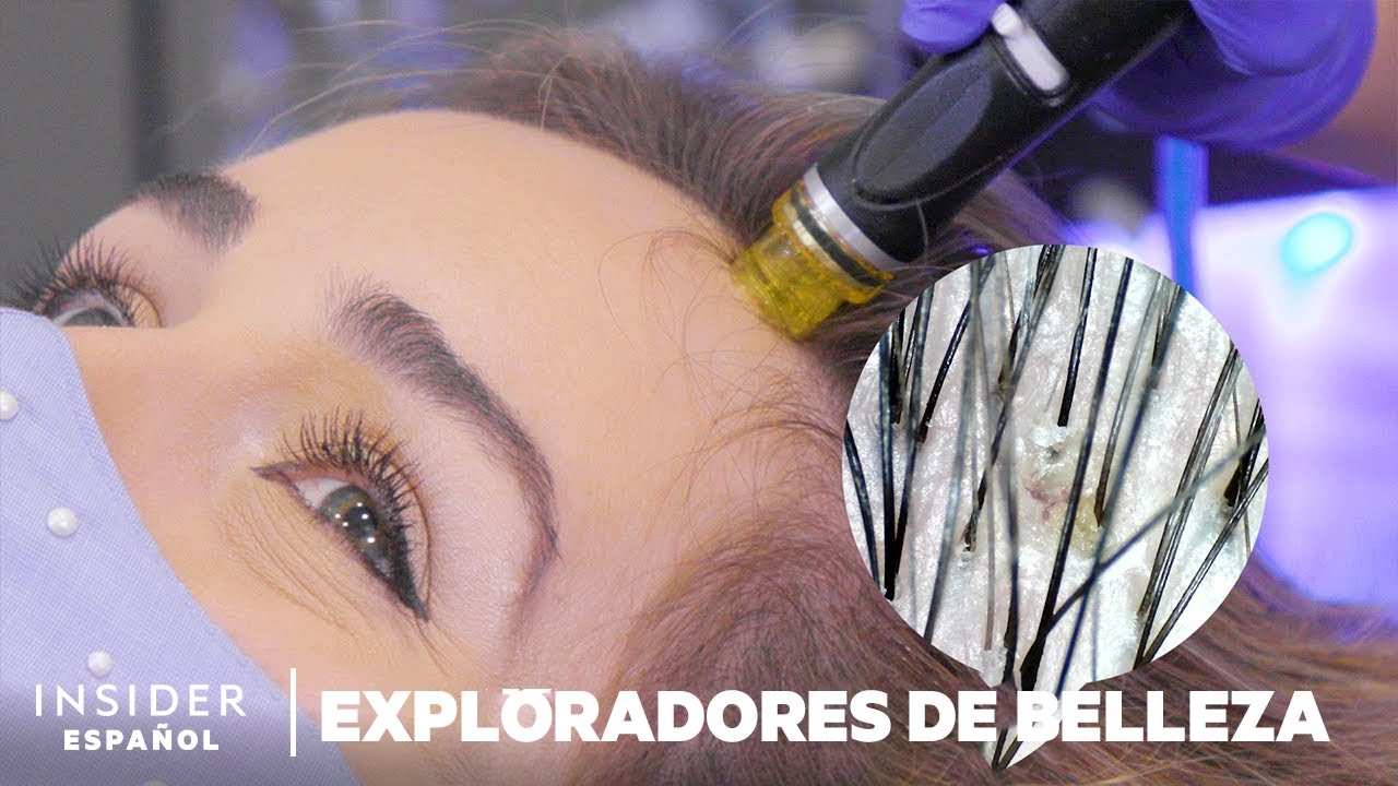 Elimina las impurezas de tu cuero cabelludo con HydraFacial Keravive | Exploradores de belleza