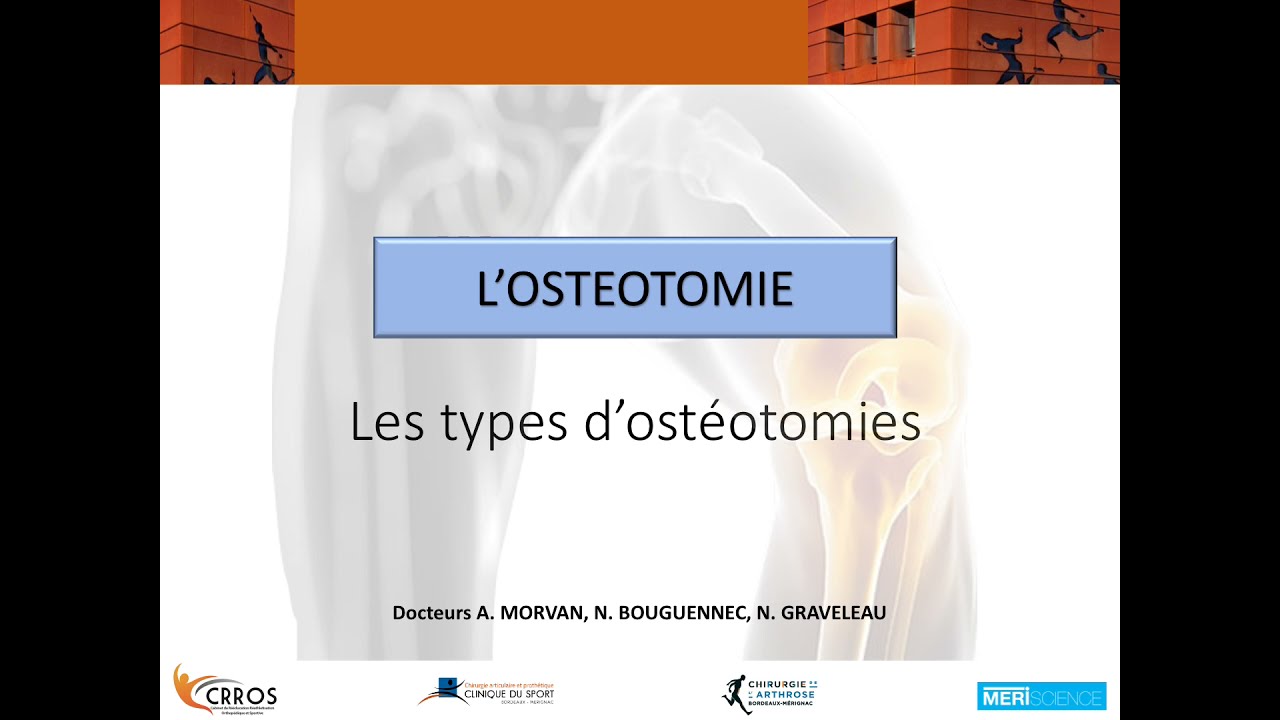 Les différents types d'ostéotomie
