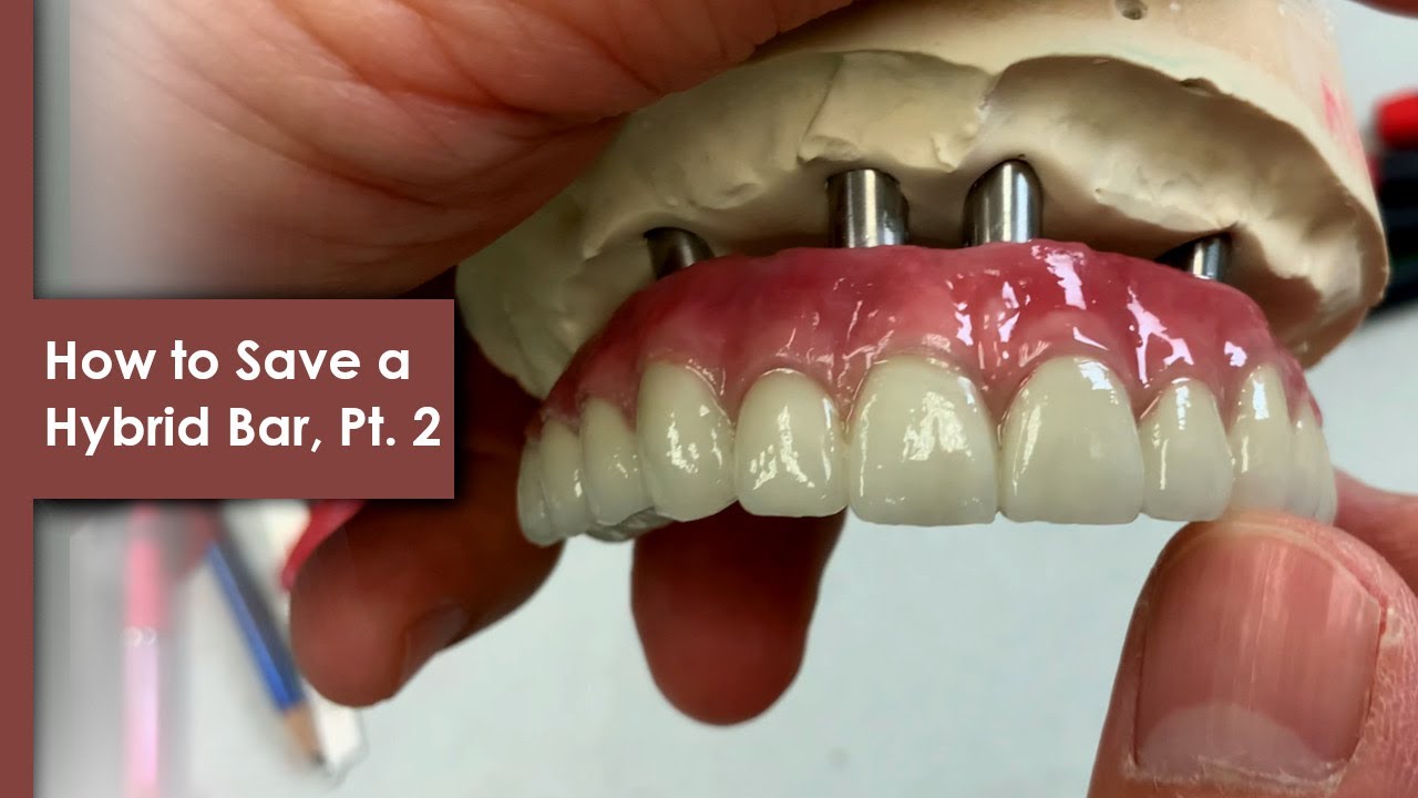 How to Save a Hybrid Bar, part 2