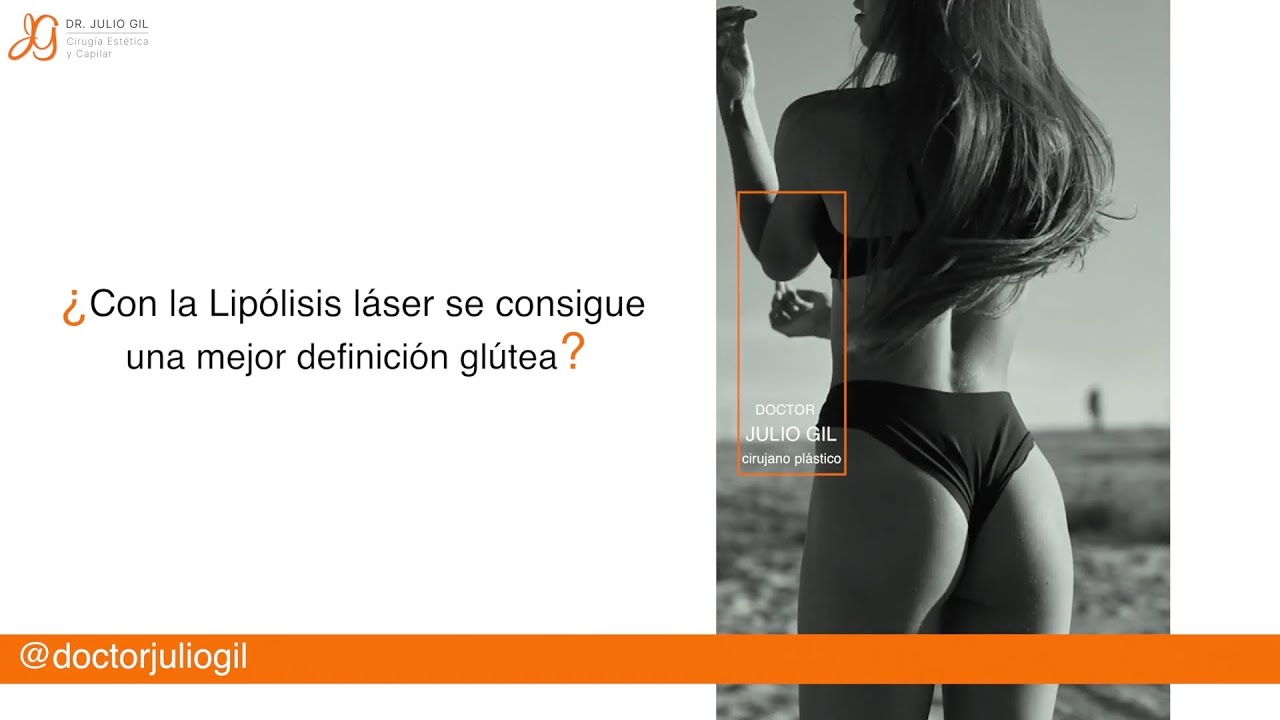 Lipolaser vs liposuccion (Diferencias, Riesgos, ¿ideal para modelos?, Testimonio)