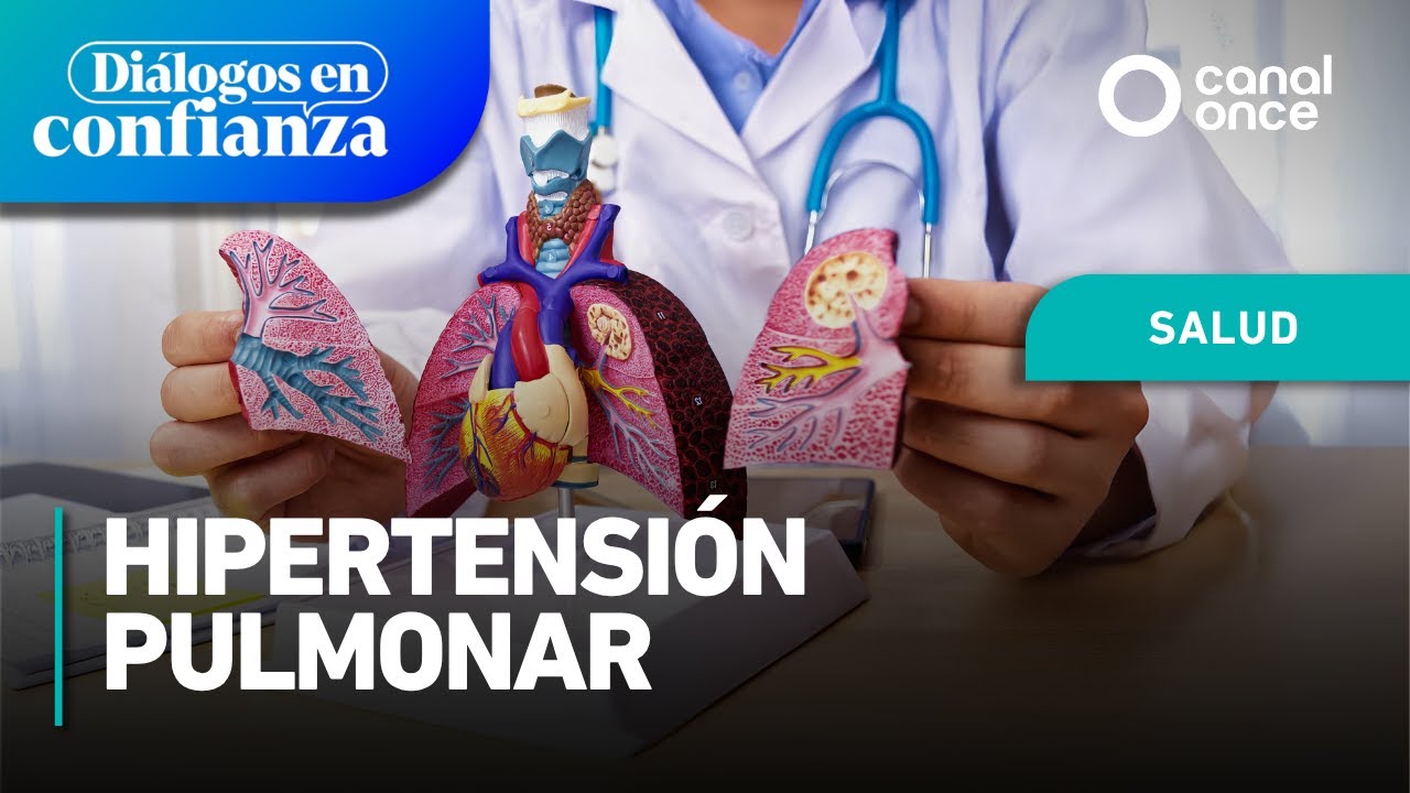 Diálogos en confianza (Salud) - Hipertensión pulmonar (16/06/2025)