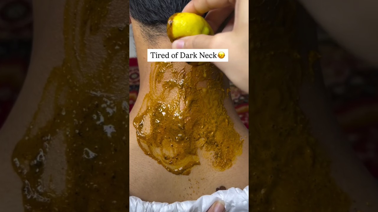 Get Rid Of Dark Neck & Remove Tan 💫✨#darkneck #darknecksolution #removebodytan #ytshorts #shorts