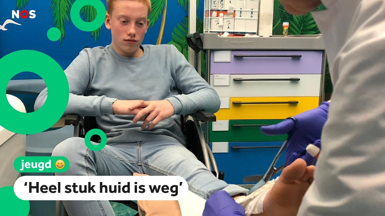 Siebren raakte gewond door vuurwerk in zijn laars