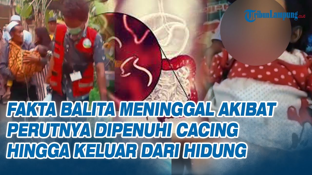 Fakta Balita Meninggal Akibat Perutnya Dipenuhi Cacing hingga Keluar dari Hidung