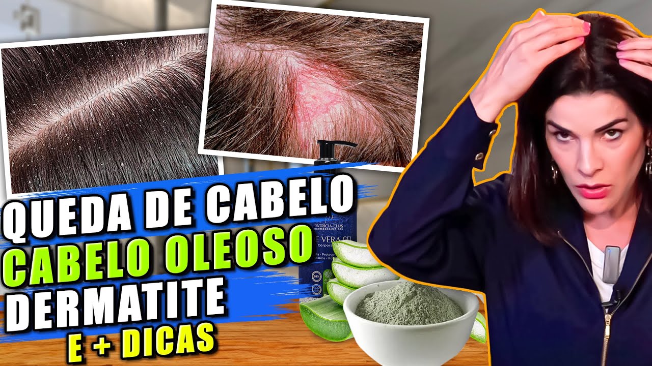 3 Receitas para Tratar a Queda Capilar e o seu Couro Cabeludo