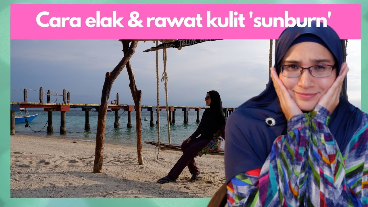 Apa nak buat untuk elak dan rawat kulit wajah yang terbakar (sunburn)