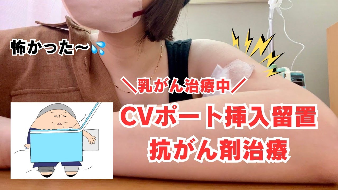 【乳がん治療中】CVポート挿入留置手術からの抗がん剤治療