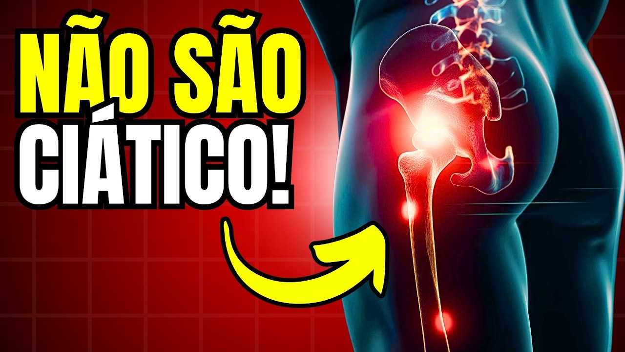 9 Causas De Dor Na Perna Que NÃO São Ciático (Descubra Sua Dor Neuropática)