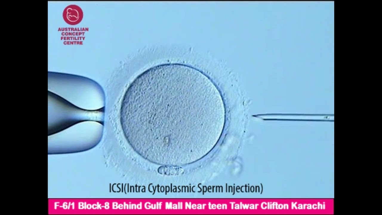 IVF , ICSI Fertilization By Pakistan Best Embryologist | Australian Concept Fertility Centre Karachi