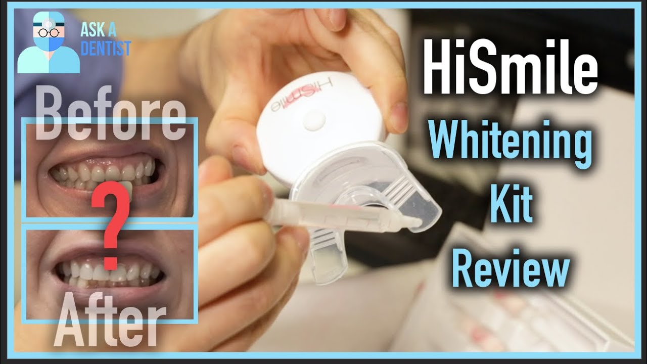 Ask a Dentist: Don&rsquo;t Try HiSmile Until You Watch This!