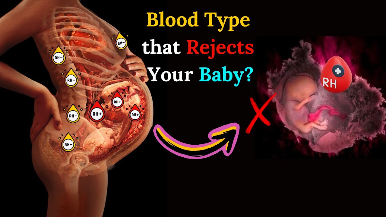The Hidden Blood Type That Can Endanger Pregnancy🩸 Rhesus Isoimmunization Explained
