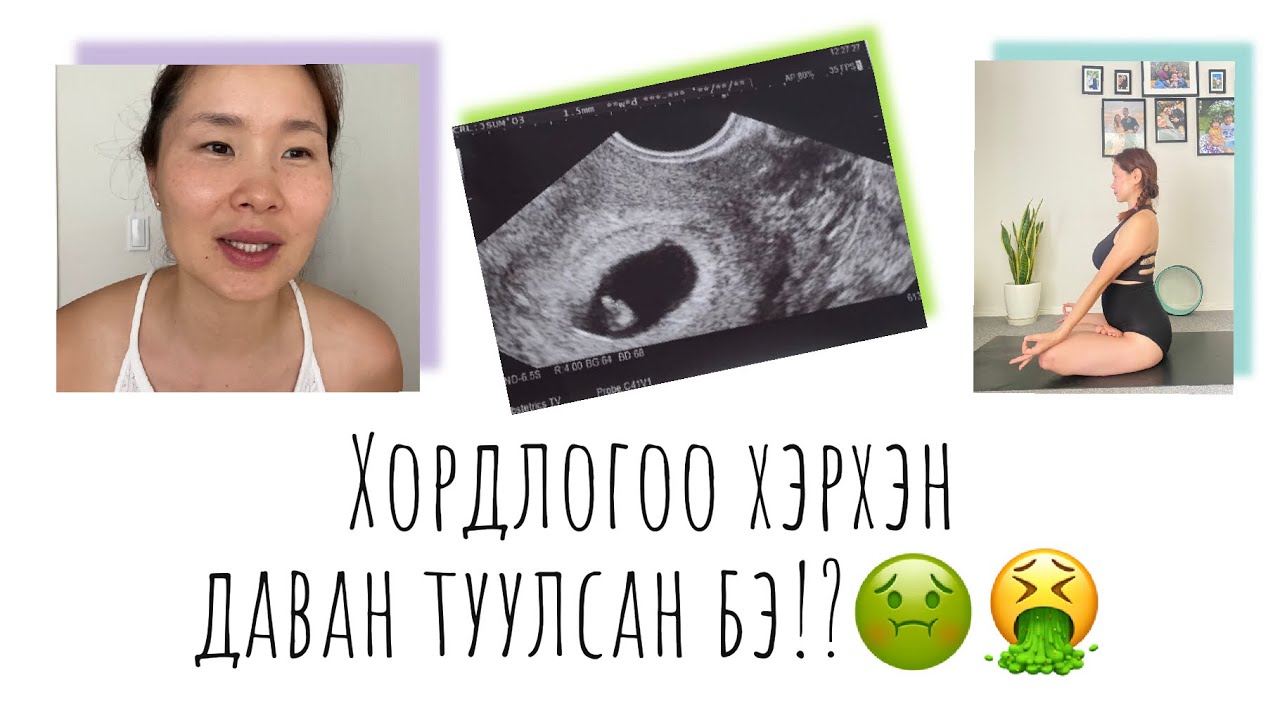 Жирэмсний тэмдэглэл влог#86🤰🏻