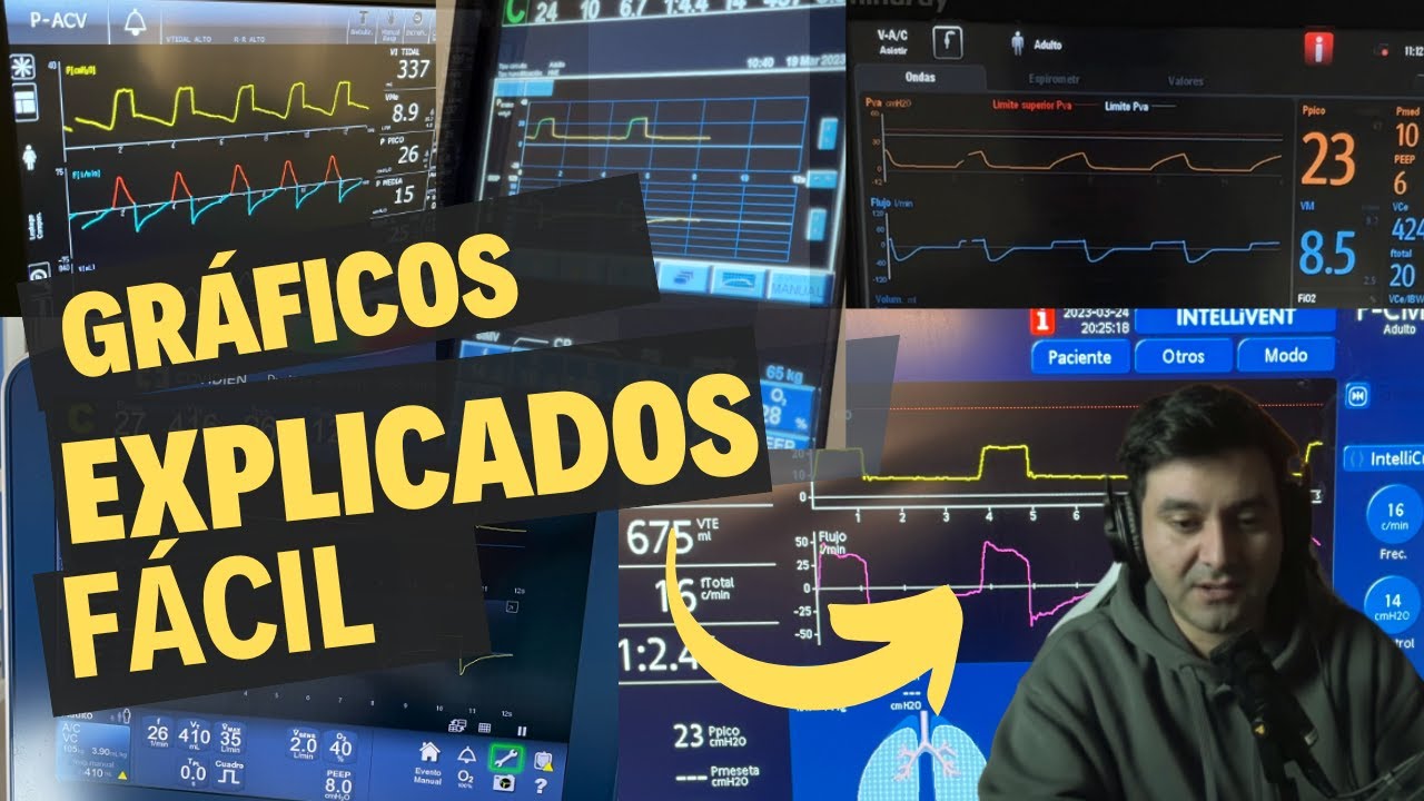 Gr&aacute;ficos- Curvas  y Bucles del ventilador mec&aacute;nico Explicados F&Aacute;CIL | &iexcl;Entiende Todo! (2025)