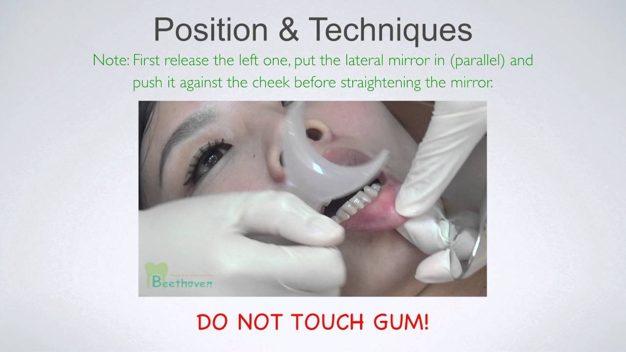 CC371. How to Take Amazing Dental Photos?