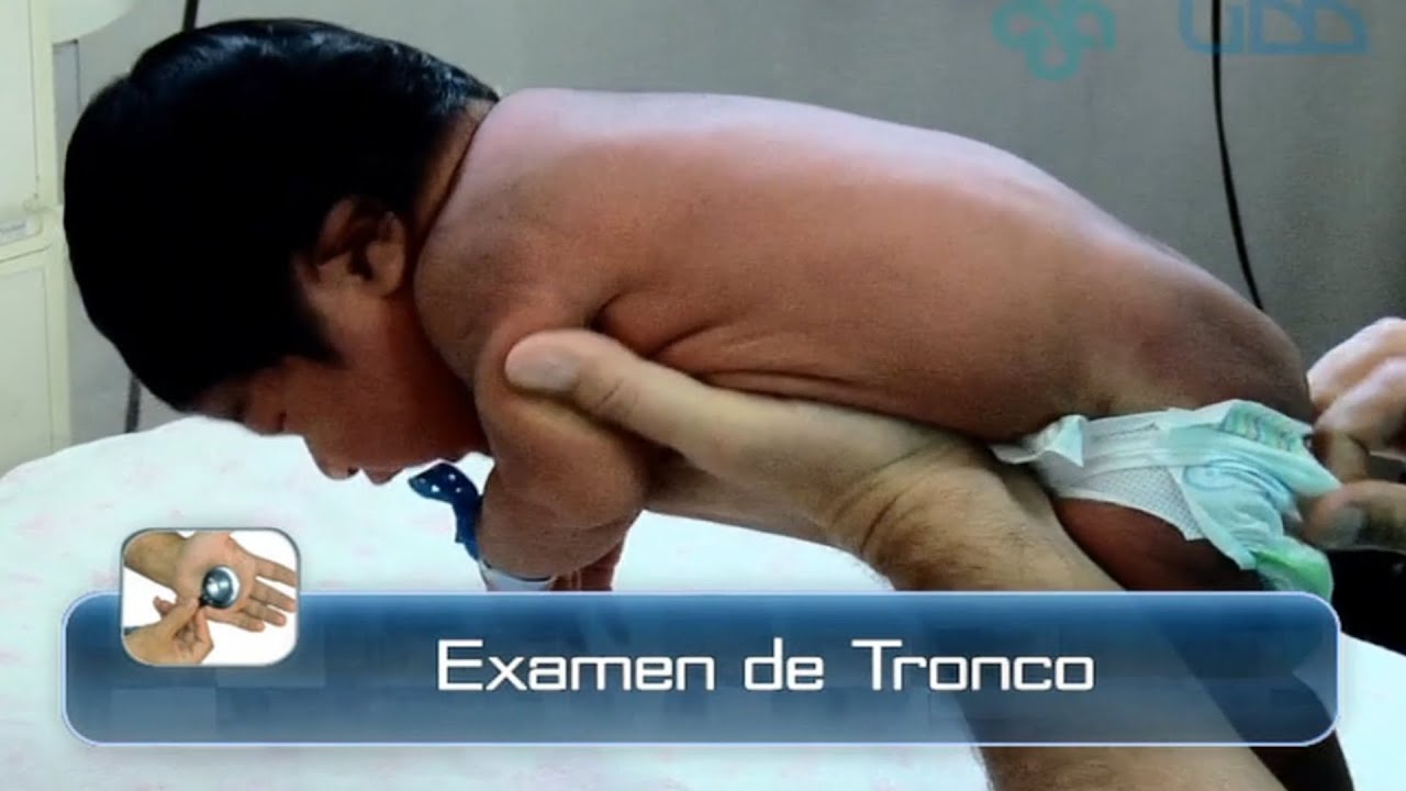 🌟EXAMEN DE LA ESPALDA DEL RECIÉN NACIDO🌟