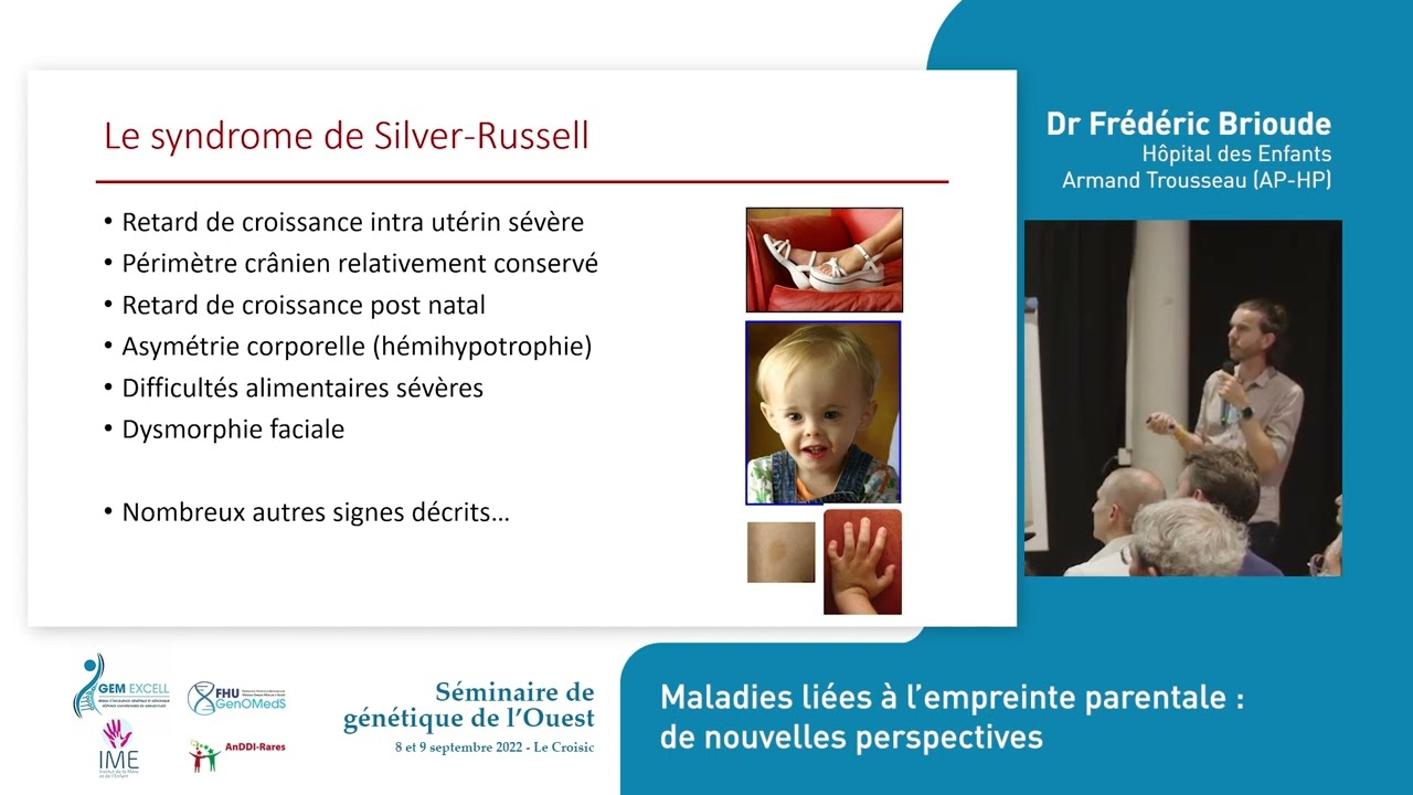 Séminaire de génétique de l’Ouest - 8) Frédéric Brioude