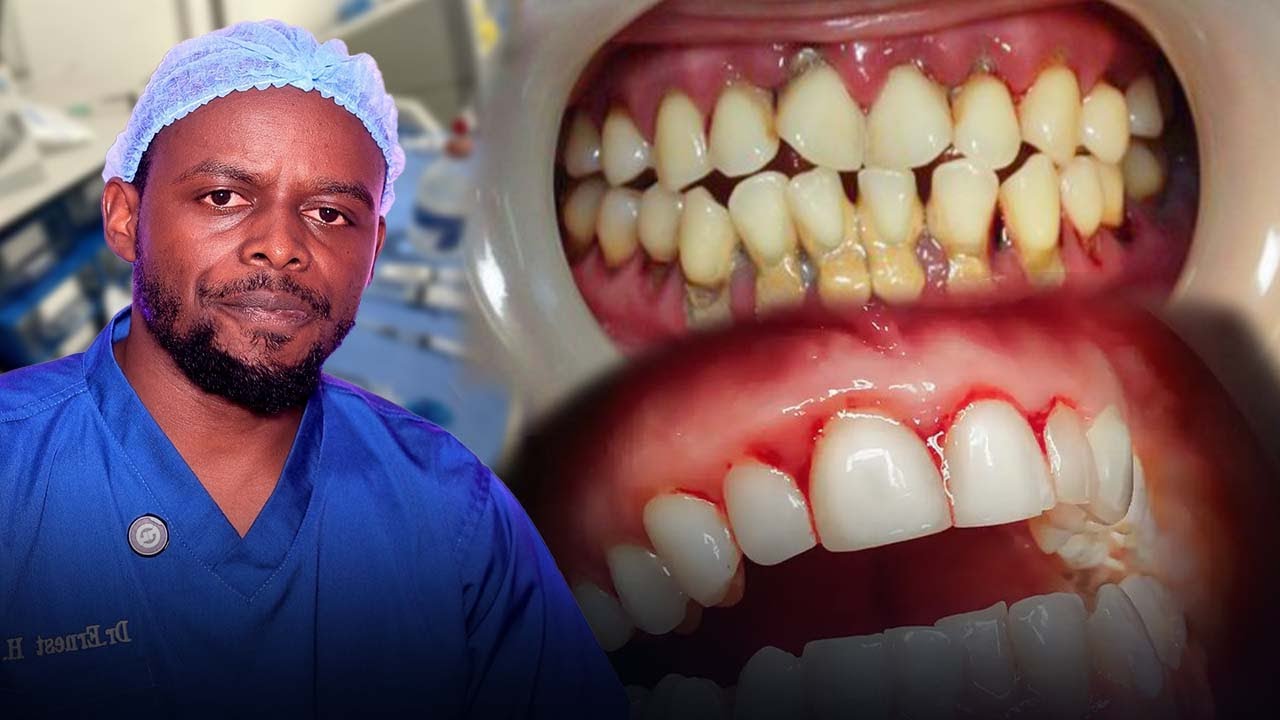 IFUMBI, KUVA AMARASO NDETSE N’IMPUMURO MBI MU KANWA |DR.ERNEST