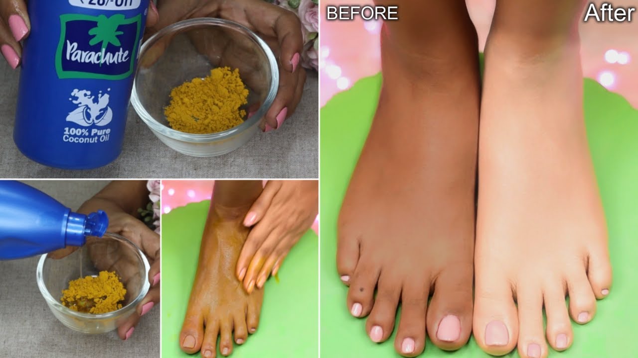 धुप से जले और काले पड़े पैरों हाथों को ऐसे गोरा करे 1 Use में-Easy Full Body Whitening & Brightening
