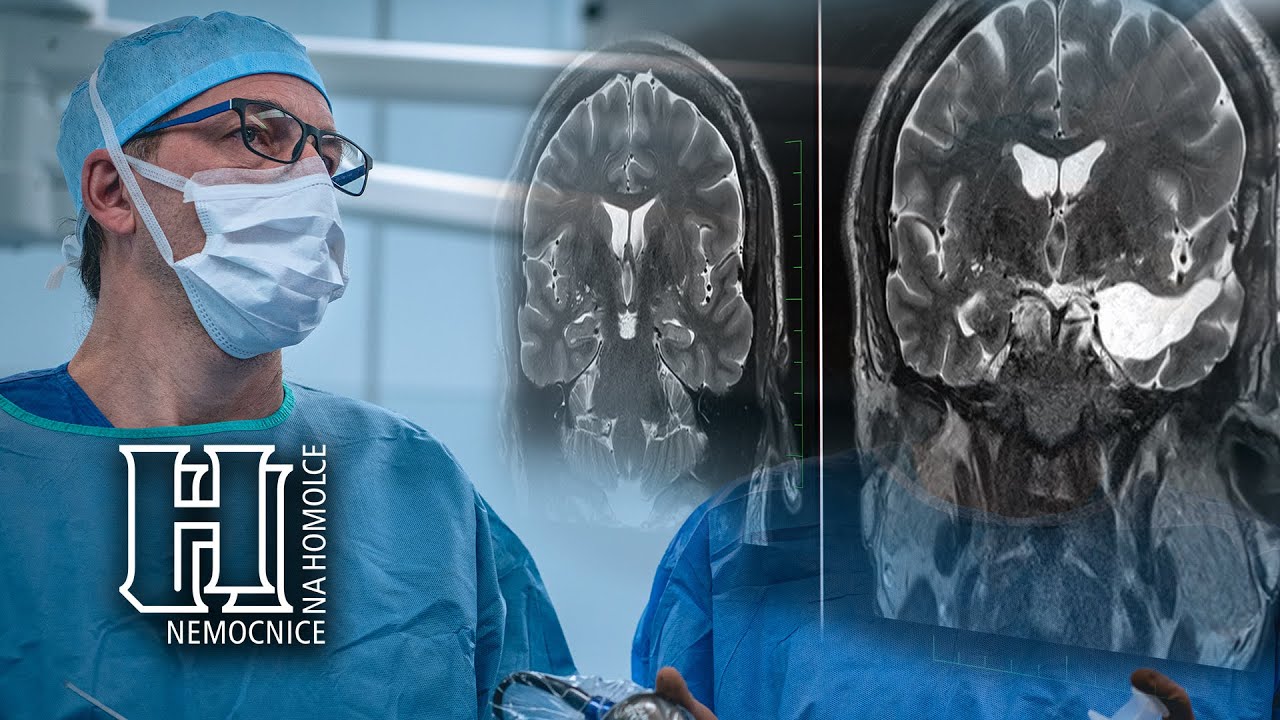 Světový den epilepsie 26. března