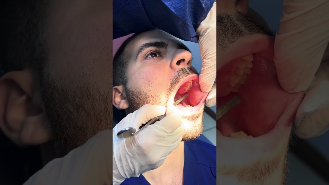 Examination of the salivary and thyroid glands Part 5