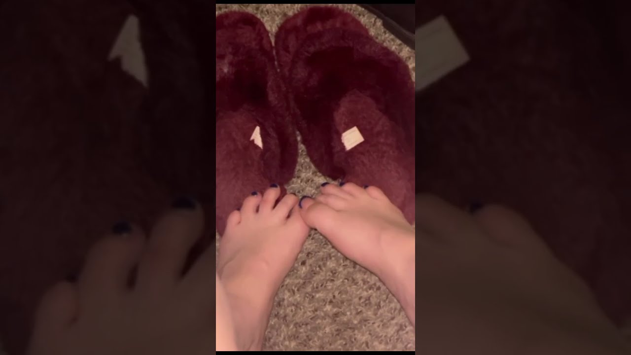 Sammy showing off her new toes! 