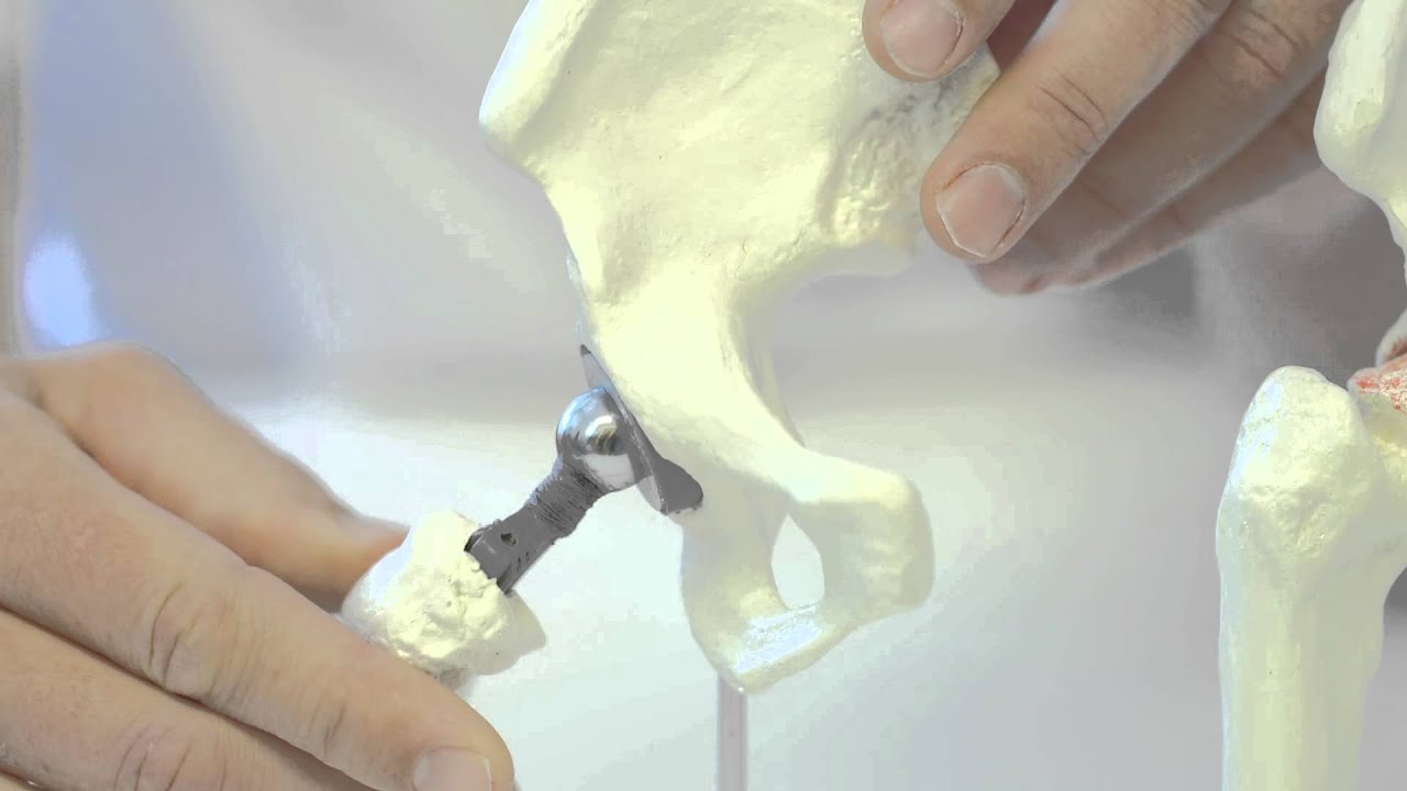 Orthopedisch chirurg Harald de Man Stichting Orthopedie Rijnmond