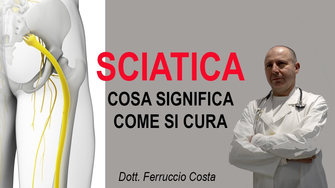 Cos'è la sciatica e come si cura