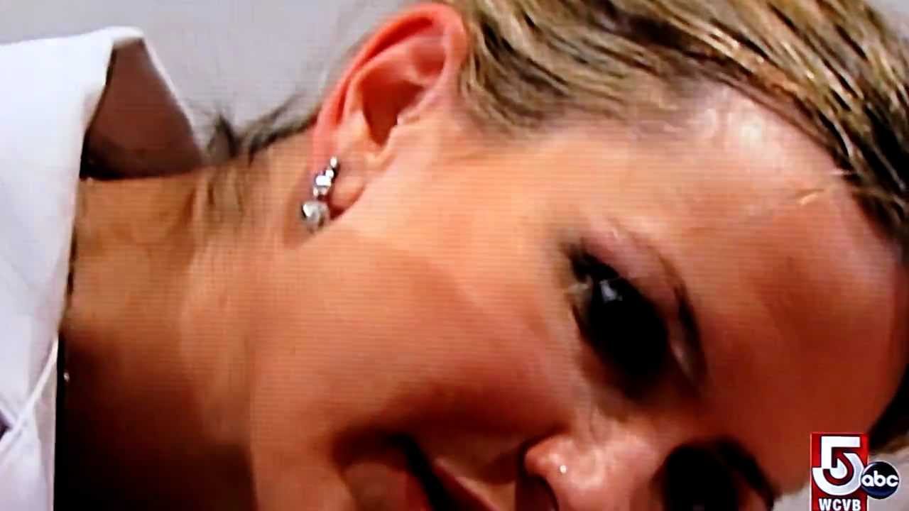 Liquid Nose Job™ on ABC news, non-surgical nose job Boston