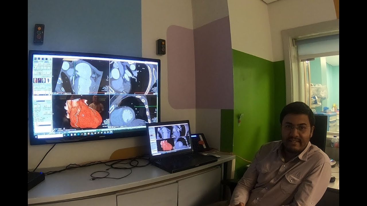 Cardiac Chambers identification by cross sectinal imaging CT & MRI