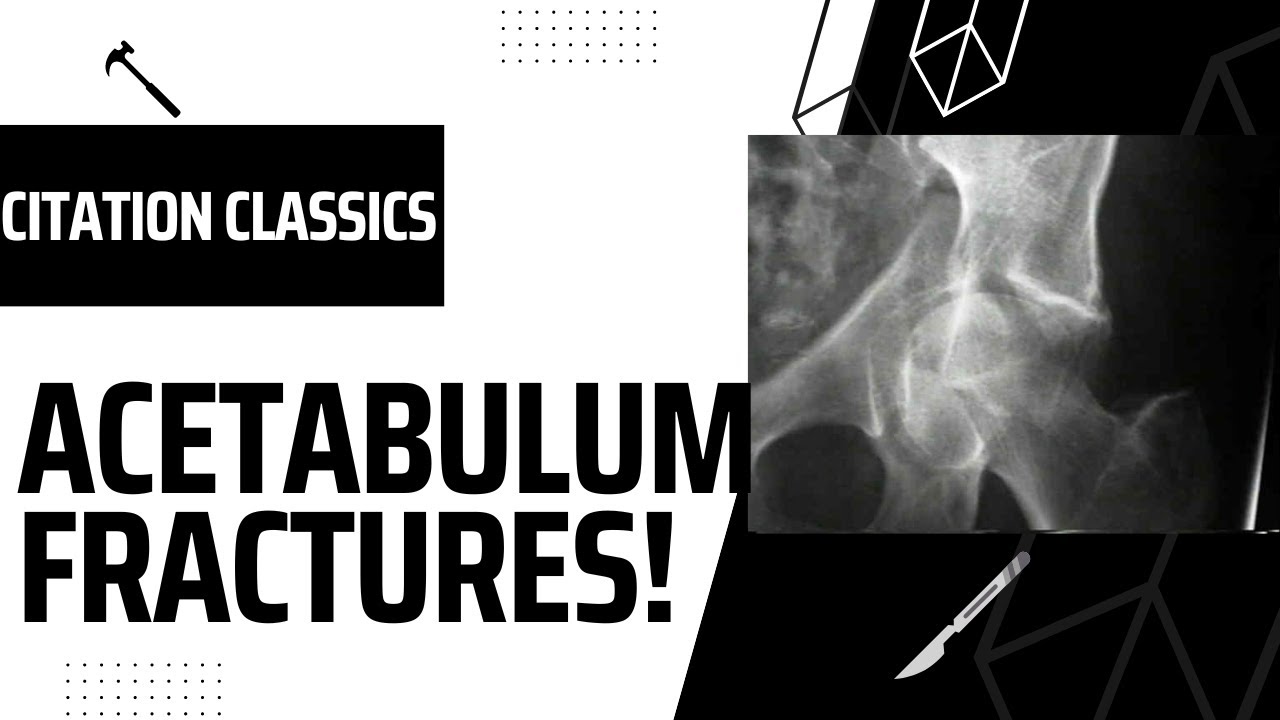 Trauma Citation Classics: Acetabulum Fractures