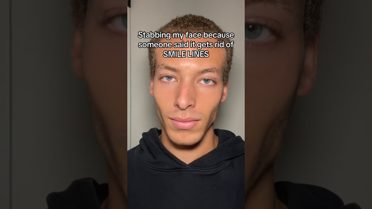 Smile Lines / How to get rid of Smile Lines