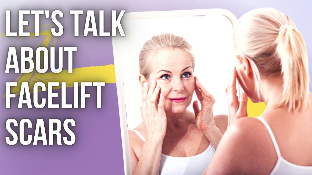 Let's Talk About Facelift Scars | Lesson Of The Day