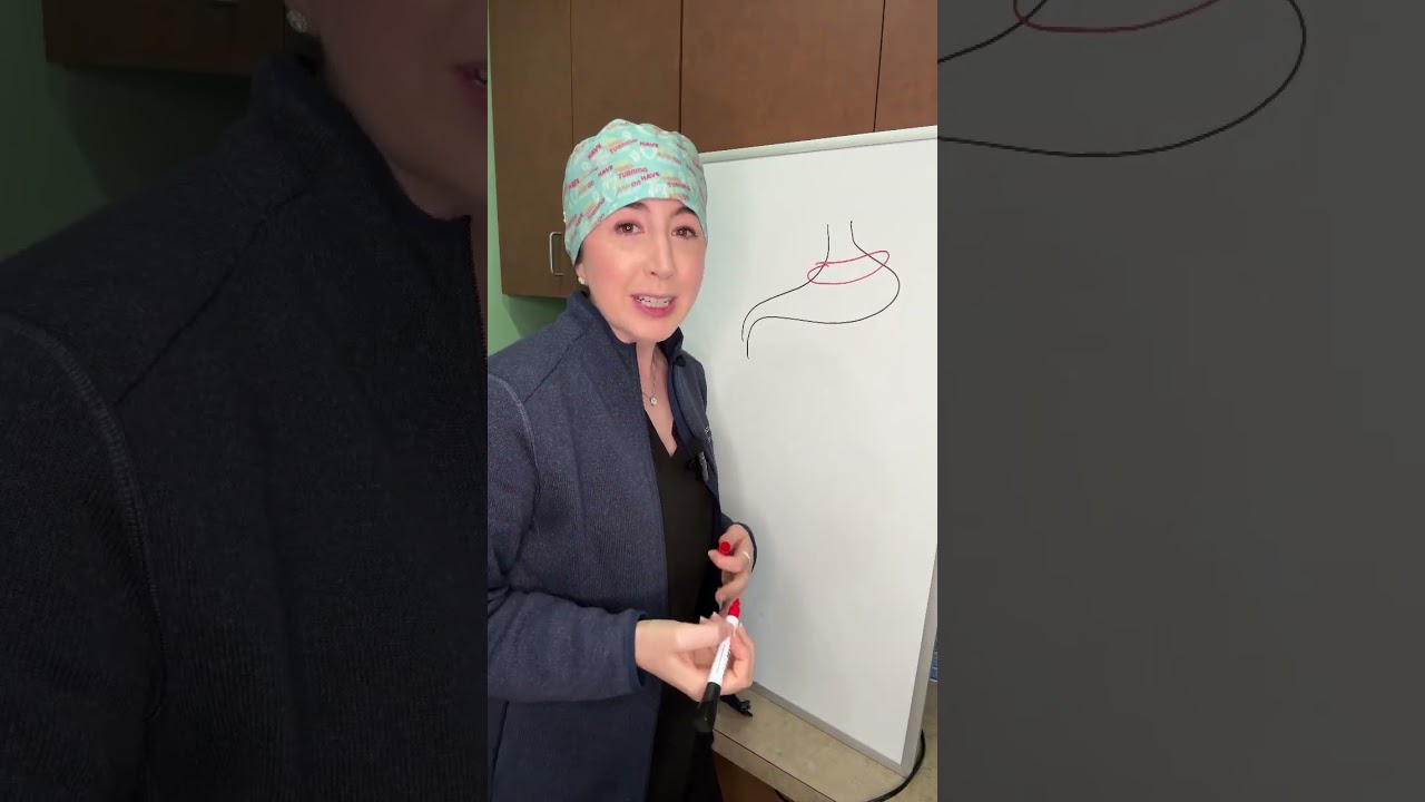 Виды бариатрической хирургии. Часть 1.