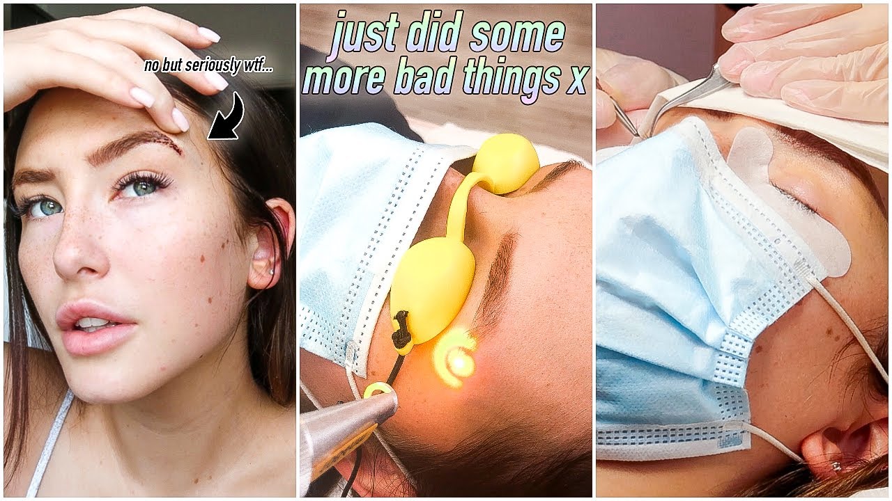 TRANSFORMATION PART 2! BROW REMOVAL & MORE! i'm actually quite concerned this time... | Hannah Renée