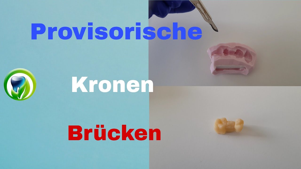 Provisorische Kronen und Brücken mit Patientenfall | Versorgungsabdruck | kein Langzeitprovisorium