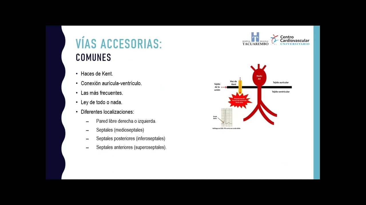 Seminario 14: Vías accesorias