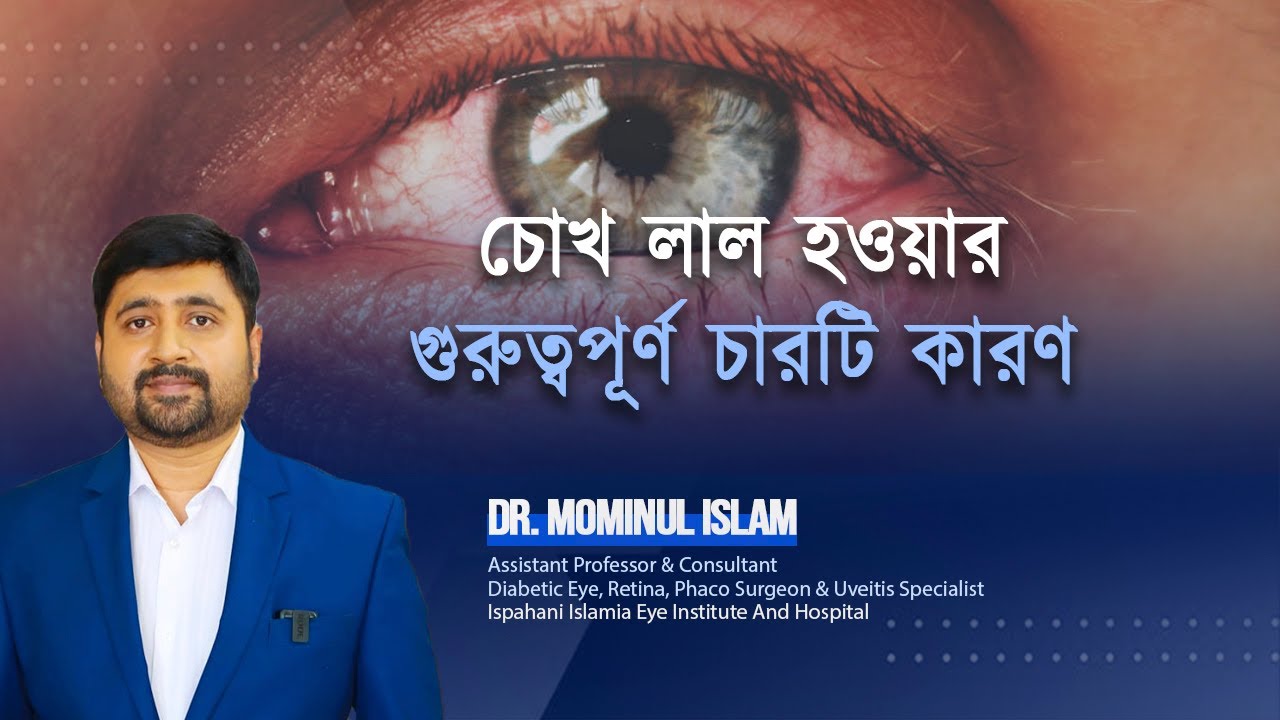 4 Eye Tips to Get Rid of Red Eyes!চোখ লাল হওয়ার চারটি গুরুত্বপূর্ণ কারণ
