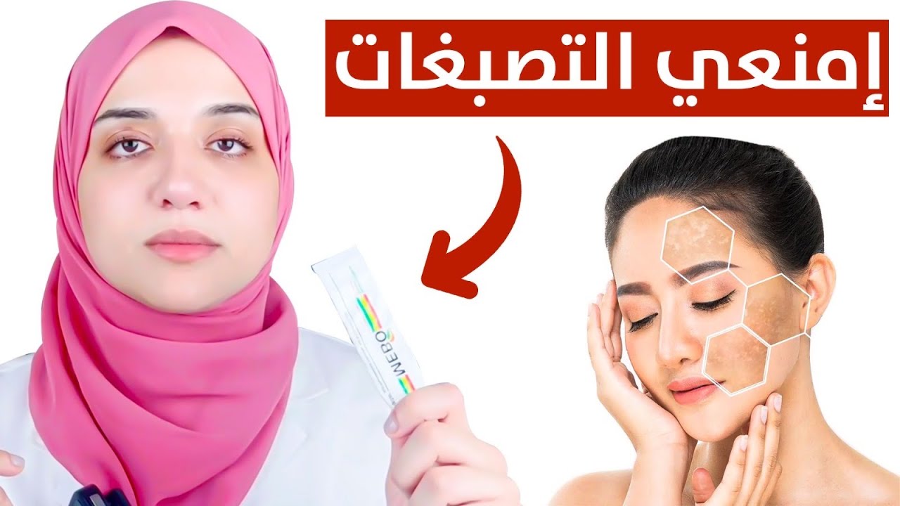 الكريم المنقذ / ارخص كريم لمنع التصبغات و البقع واثار الحبوب في البشرة