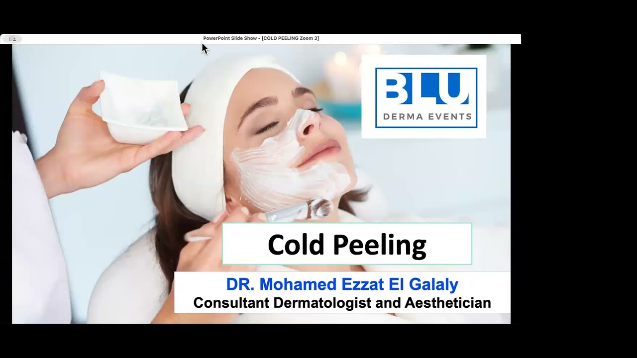 Cold Peeling