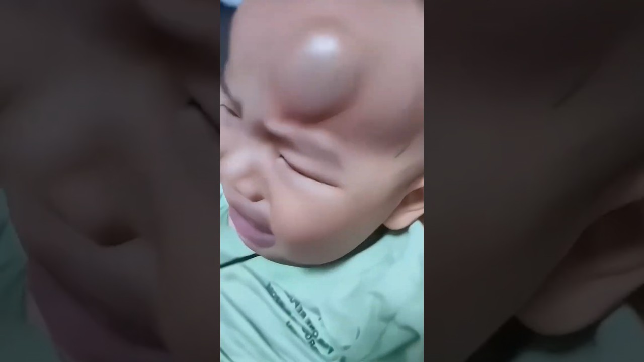 MIND-BLOWING Benefits of Adjustable Baby Helmets