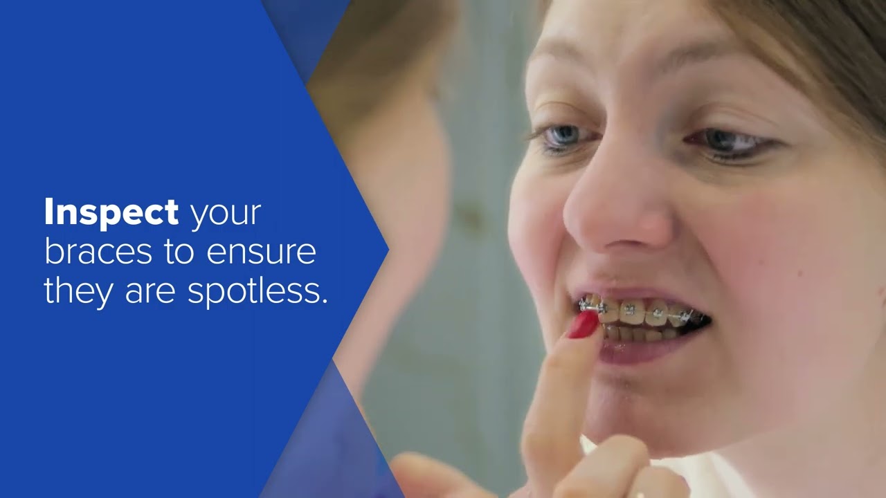 The Why's and the How's of Brushing and Flossing while wearing Braces!