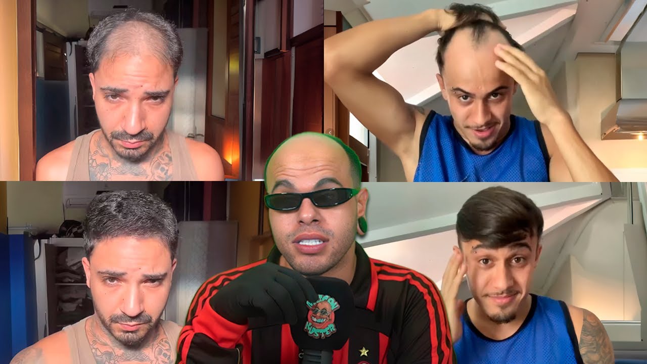 homens disfar&ccedil;ando a calv&iacute;ce