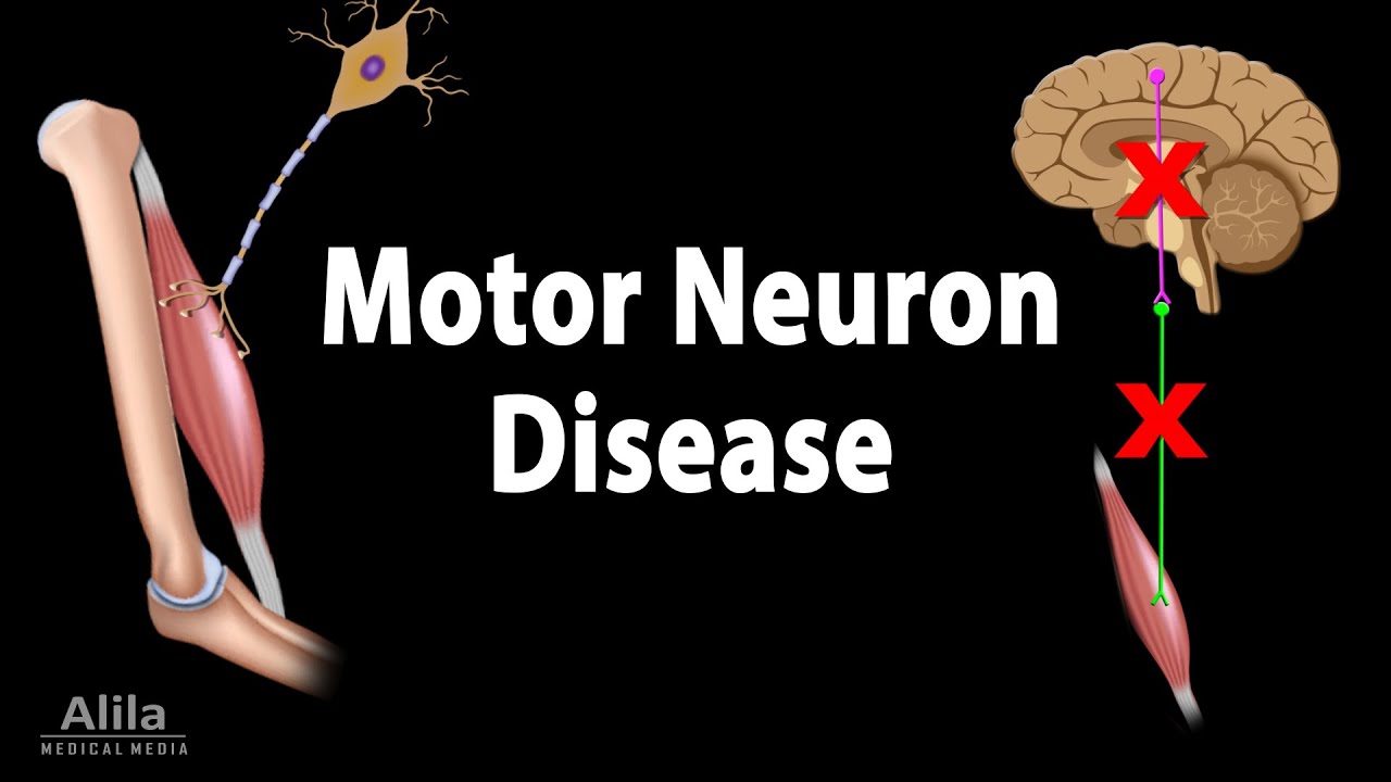 Motor Neuron Disease, Animation